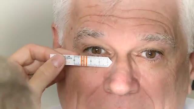 Demonstration of Bimatoprost Ring for Sustained Release Glaucoma Drug Delivery