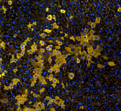 Regenerated Liver Cells