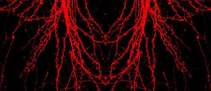 Hippocampal Neuron