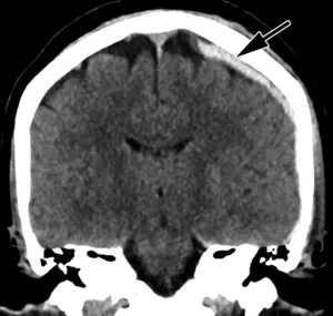 Head CT of intimate partner violence patient