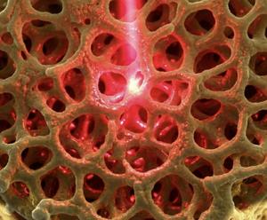 Nanoporous gold
