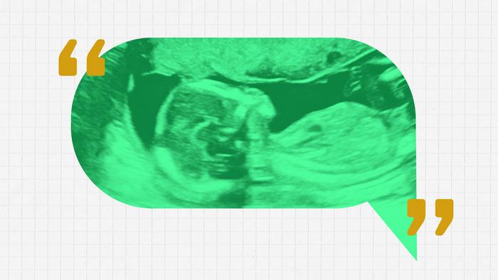 Ultrasound messaging