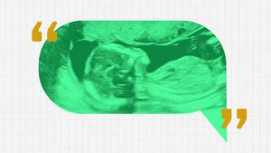 Ultrasound messaging