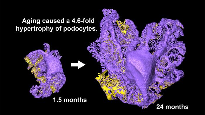 Whole-cell three-dimensional reconstruction of a podocyte in rats kidney
