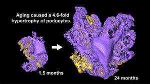 Whole-cell three-dimensional reconstruction of a podocyte in rats kidney