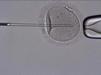 Fear of Treatment Puts Stress on Women Undergoing Fertility Therapy