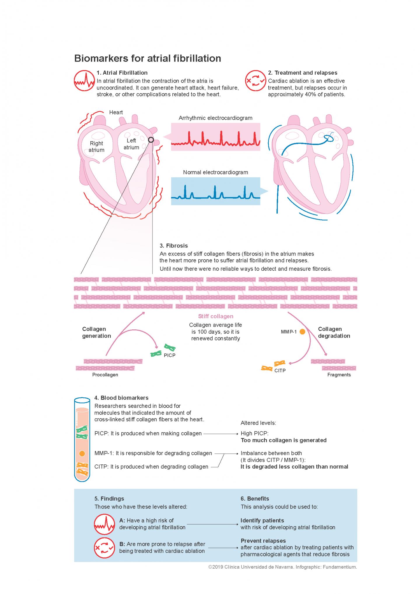 Biomarkers for Atrial Fibrillation