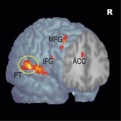 Sound Imaging the Brain