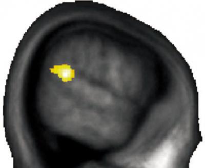 Gray Matter