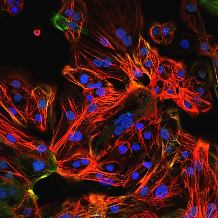 Human iPS cell-derived cardiomyocytes
