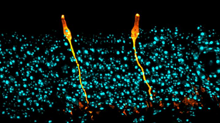 Pulmonary Ionocyte