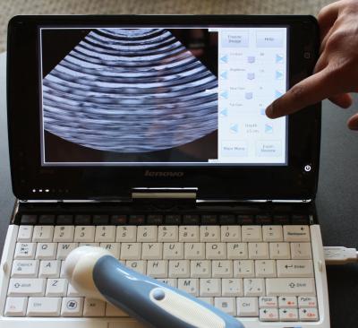 Netbook Ultrasound Interface