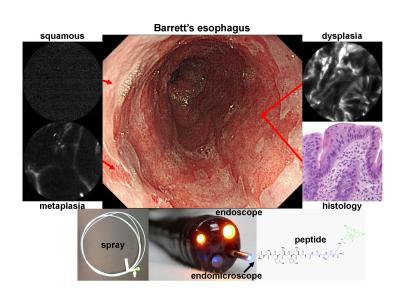 Fluorescent Peptides Shine Light on Esophagus (1 of 1)
