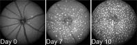 Microglia Repopulating Retina