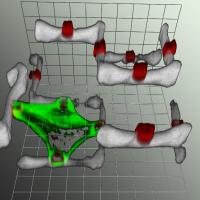 Laser-scanning Microscopy