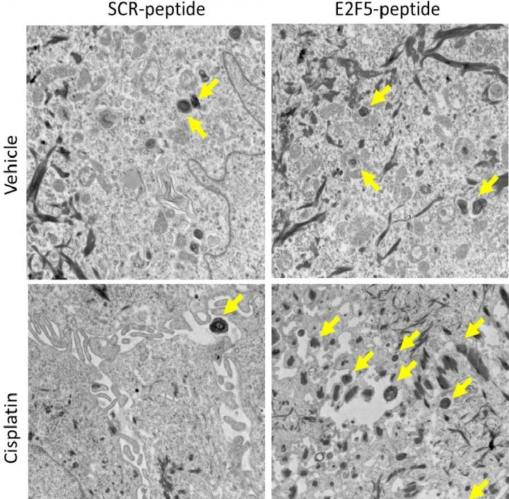 Electron Microscopy Images Obtained from Human Oral Cancer Xenograft-Derived Tumors