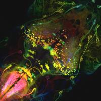 Newly discovered brain circuit