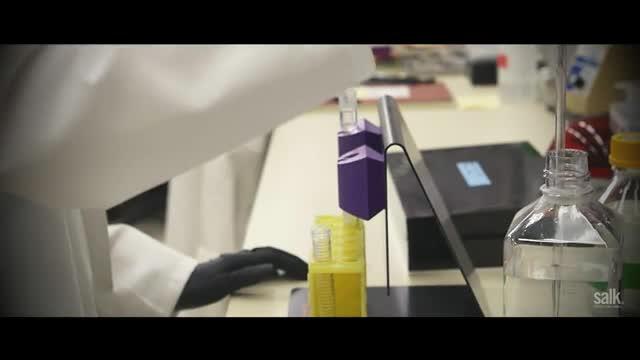 Salk Scientists Show How Immune Receptors Clear Dead and Dysfunctional Brain Cells