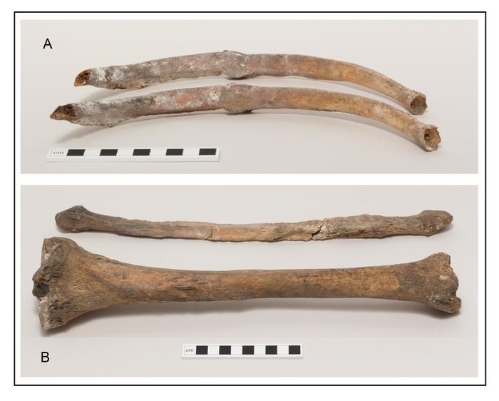 Skeleton: pathology