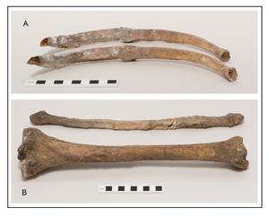 Skeleton: pathology