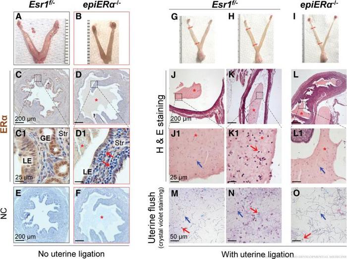Immune cells in the uterus shortly after mating.