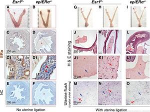 Immune cells in the uterus shortly after mating.