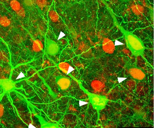 Neuronal Imaging