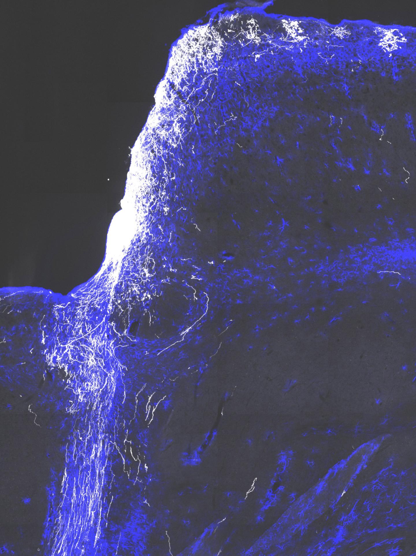Regenerating Nerve Fibers