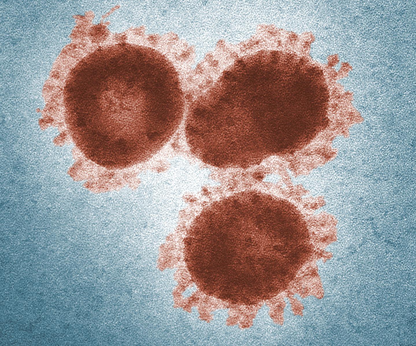 Coronaviruses
