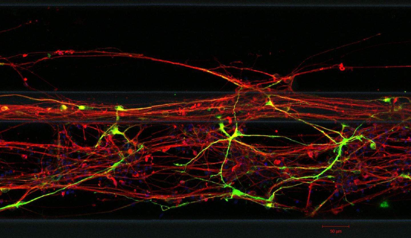 3-D Brain