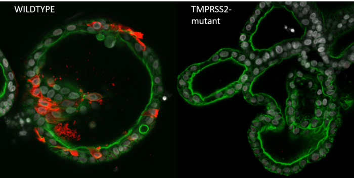 Viral infection in wildtype and mutant organoids