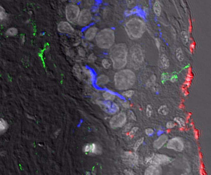 HIV Interacting with Newly Discovered Dendritic Cells