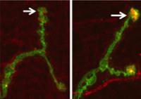 Motor Neuron 