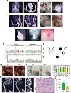 A novel MED14 variant is associated with VACTERL association in a human patient and in a mouse model
