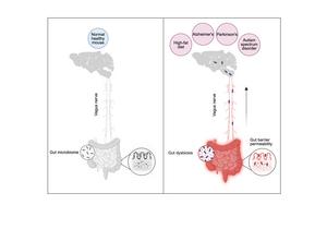 High-fat diet drives gut bacteria into the brain in mice
