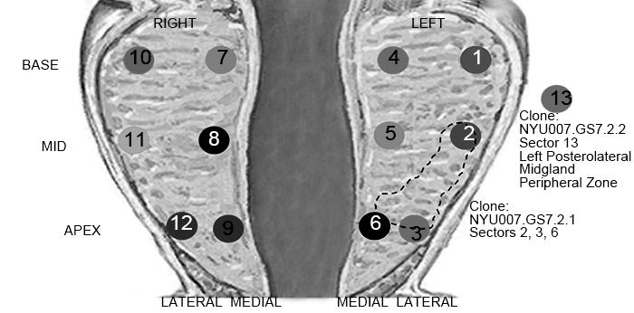 Prostate with Biospy Core Locations