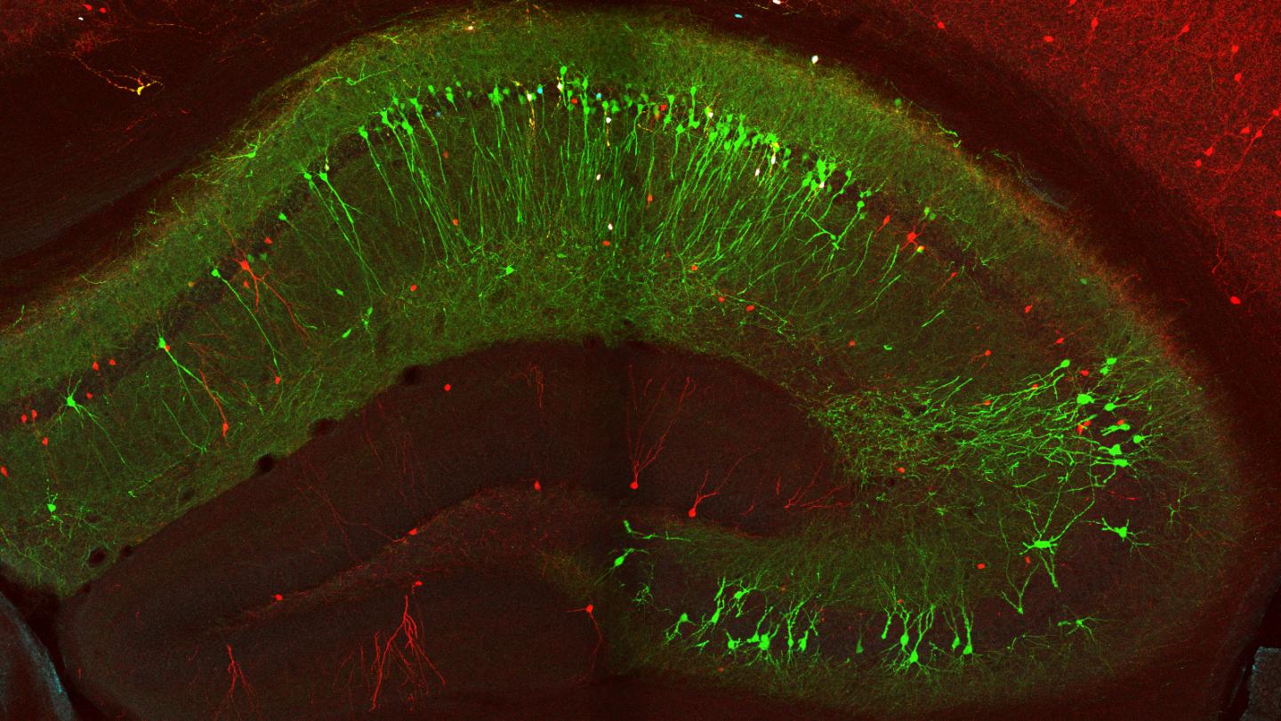 VIP Cells in Hippocampus