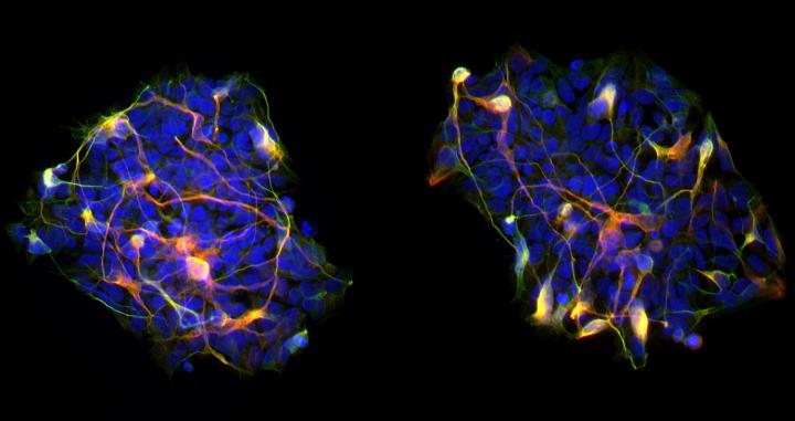 Neurons