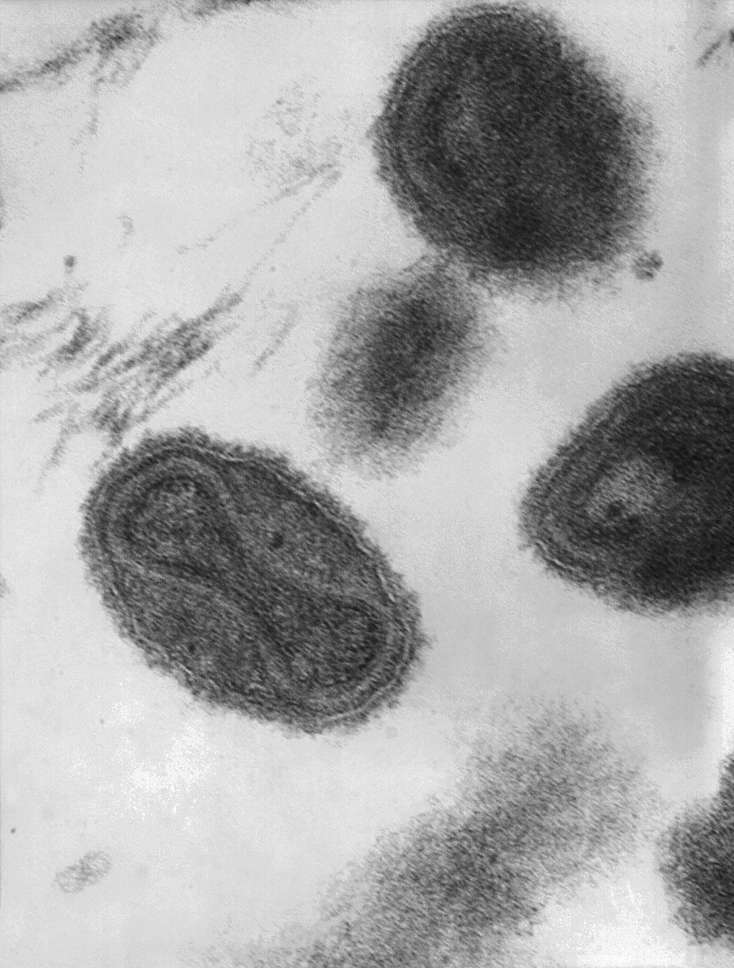 Scientists Learn How Poxviruses Defeat the Body's Host Defense