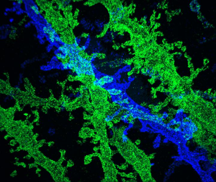 High-Resolution Imaging with Conventional Microscopes