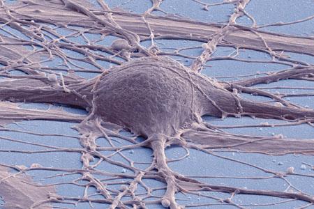 Human Derived iPSC