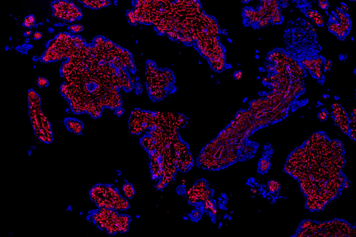 Placenta Mapping