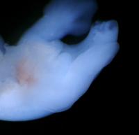 Lizard (Anolis) Embryonic Hemipenis