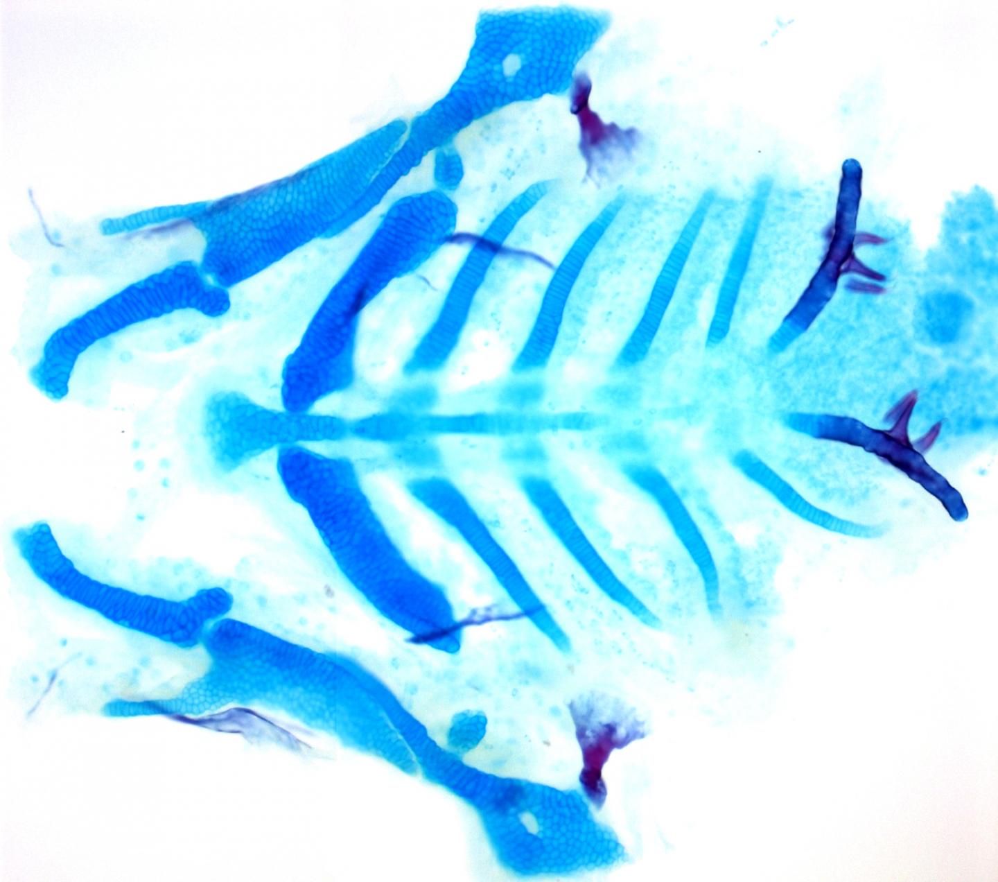 Facial Cartilage and Bone