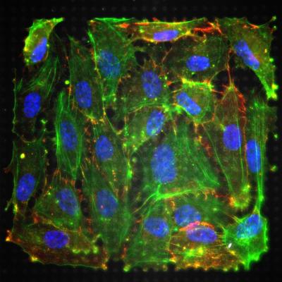 Heart Cells