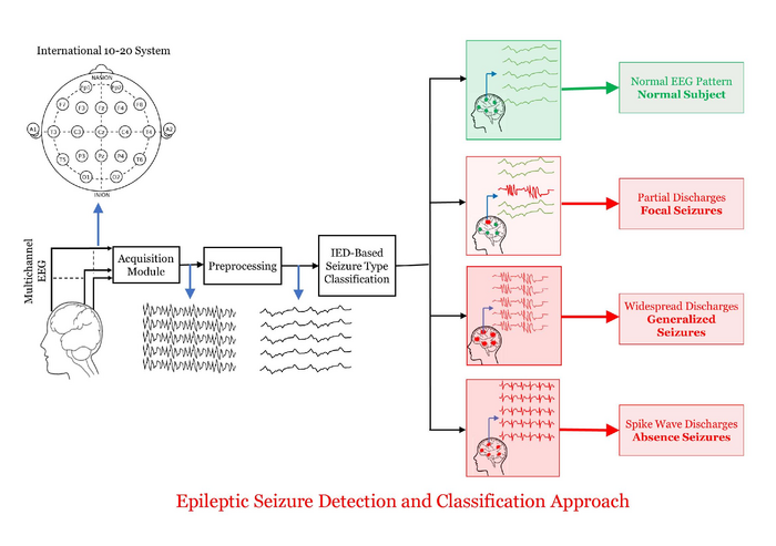Approach to detect and classify epileptic seizures