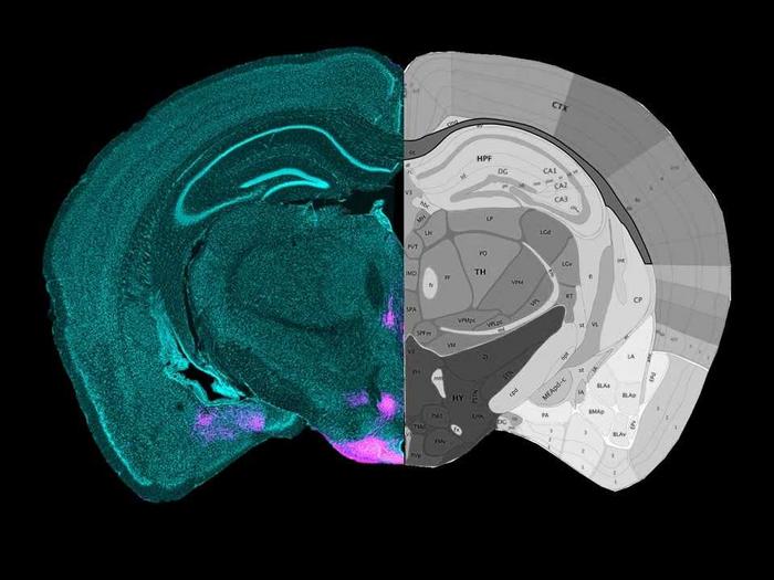Picture of the mouse brain