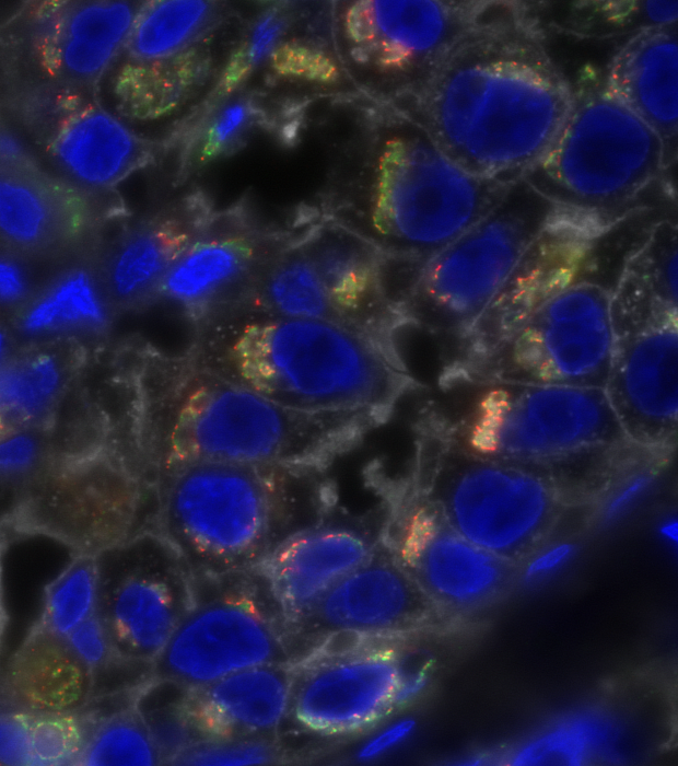 Analyzing Cancer Cells