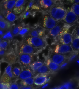 Analyzing Cancer Cells