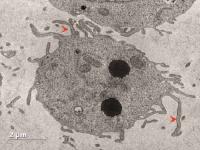 CD34 Cells
